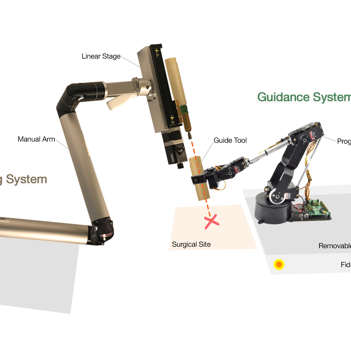 MR-Guided Robotically-actuated C1-C2 Fusion